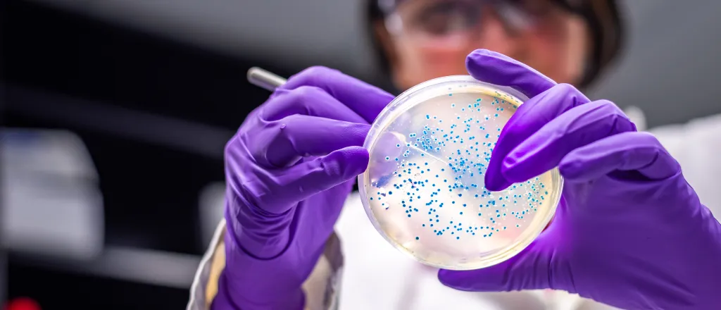 Person wearing gloves and eye protection examines a laboratory specimen dish