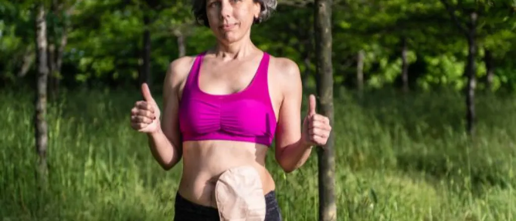 Activities you can still do with a colostomy bag