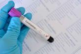 How do I know if I might have coronavirus? 5 questions answered
